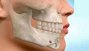 Cirugia Oral y Maxilofacial Guayaquil
