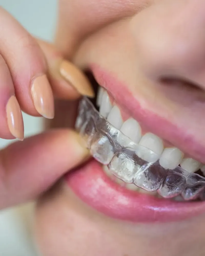 Paciente sosteniendo un alineador transparente de ortodoncia sin brackets