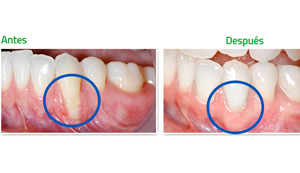 Periodoncia en Guayaquil